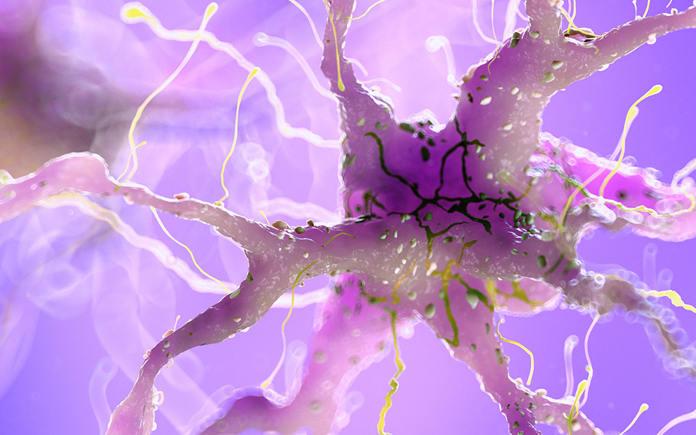 Illustration of a damaged nerve cell